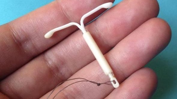 Contraception : 5 choses à savoir sur le stérilet ou DIU avant de l’utiliser